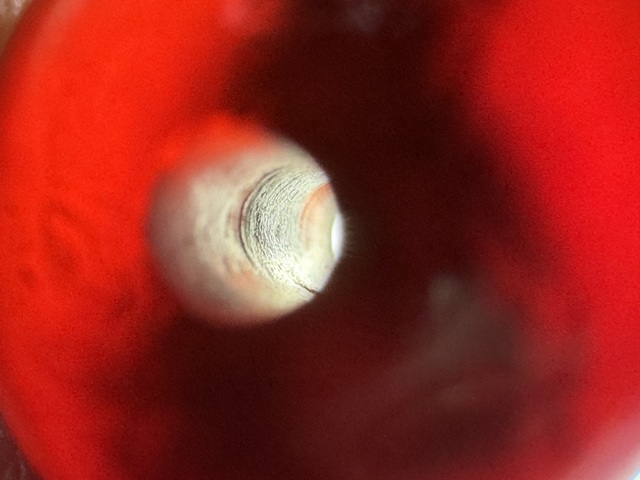 古玩玉器遼平頭瑪瑙珠真品鑒賞圖